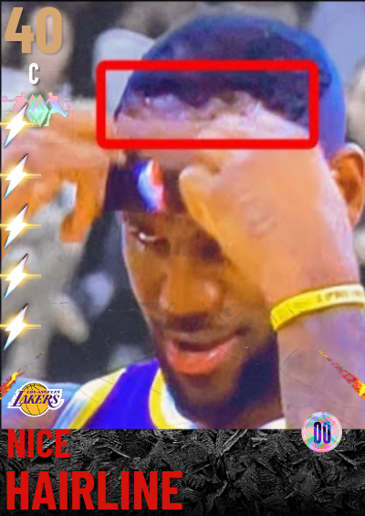 nice hairline